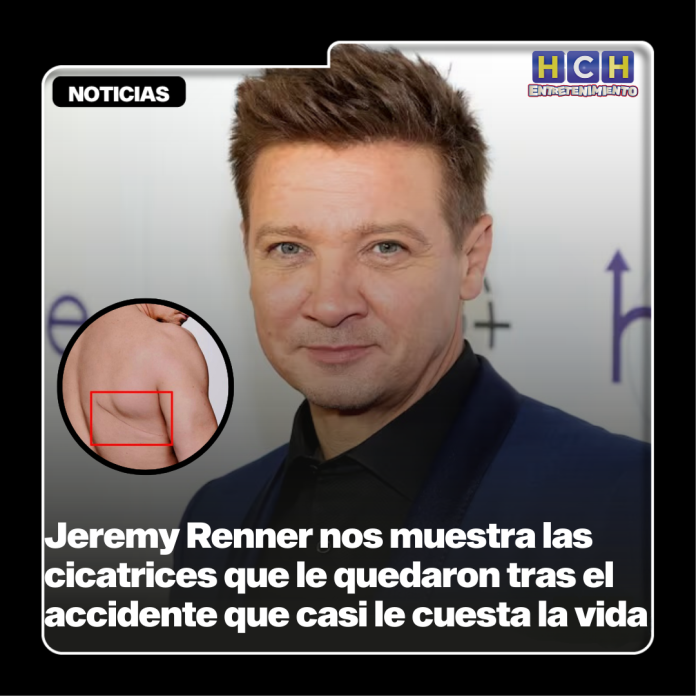 Jeremy Renner Nos Muestra Las Cicatrices Que Le Quedaron Tras El