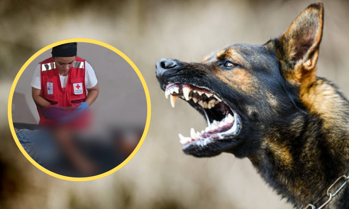 Niño de 11 años sobrevive a brutal ataque de perro sabueso en Copán