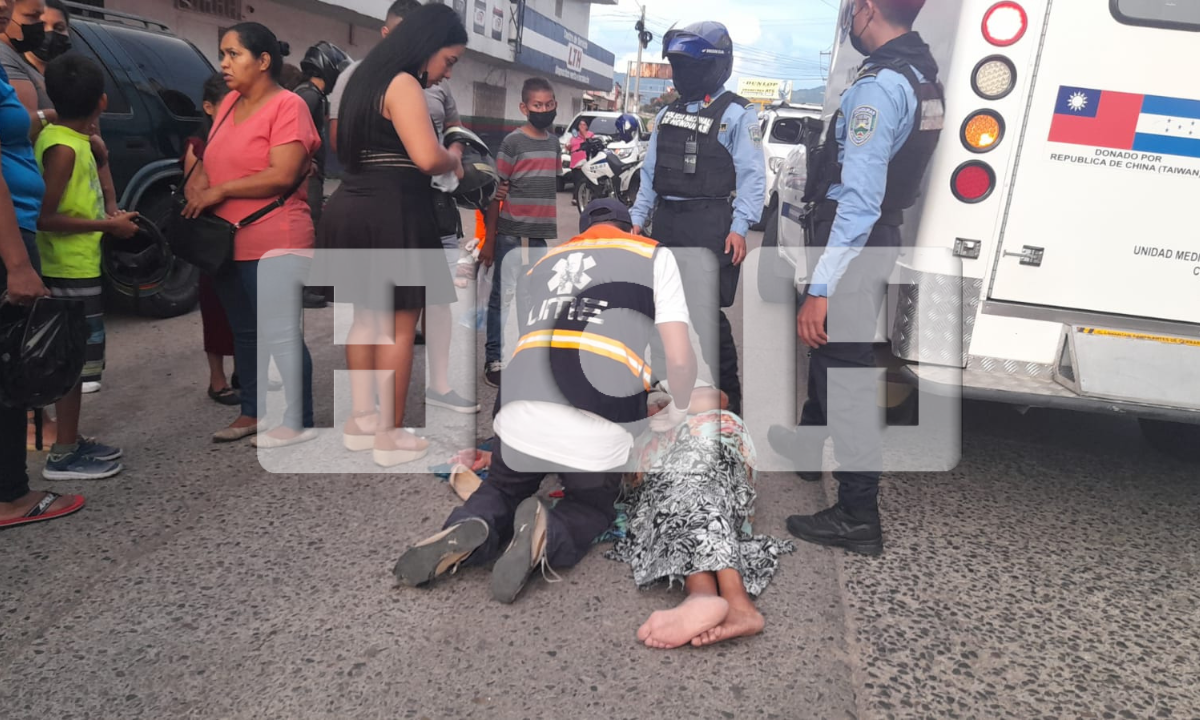 ¡tres Personas Heridas Deja Accidente De Una Motocicleta En El Desvío