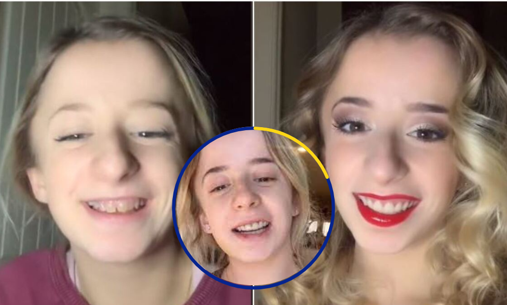 Mujer que nació con dientes transparentes ‘finalmente se siente hermosa