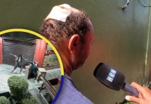 «Si no me hago el muerto, me mata»: Guardia atacado por «lunático» en La Ceiba exige justicia