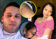 Familia de jovencita que fue atacada a mordidas tuvo que salir huyendo ante las constantes amenazas