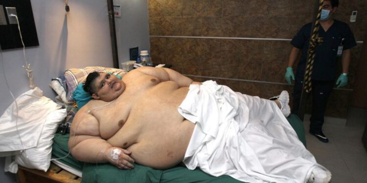 Muere el mexicano Juan Pedro Franco, conocido por haber sido el hombre más obeso del mundo