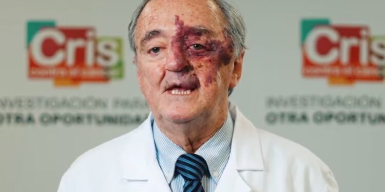 Mariano Barbacid y su equipo piden apoyo financiero para llevar su avance contra el cáncer de páncreas a pacientes