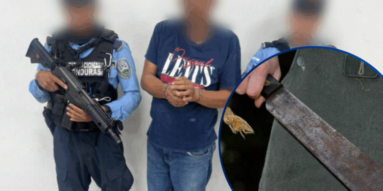 La Policía Nacional captura a hombre acusado de quitarle la mano a una menor en El Progreso