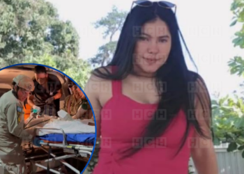 ¡No soportó! En el hospital, fallece mujer que sufrió graves quemaduras en Olancho