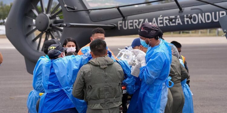 Kenia, la menor quemada tras explosión en fábrica copaneca presenta una evidente mejoría