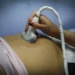 La ultraderecha chilena busca obligar a las mujeres a oír el latido del feto antes de abortar
