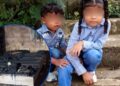 ¡Una tragedia que rompe el alma! Mueren hermanitos que luchaban por sus vidas tras incendiarse su casa en Yoro