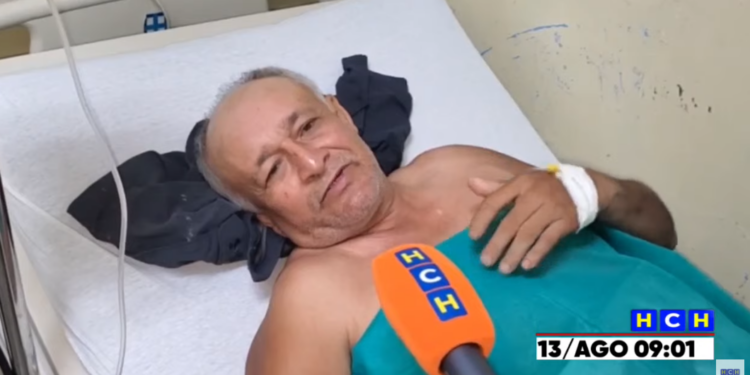 “Dios me salvó”: Hombre relata el aterrador momento en que un rayo lo alcanzó en La Ceiba; otra persona murió en la tragedia