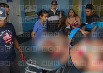 ¡Sobrevive de milagro! Mototaxista recibe cuatro impactos de bala durante brutal atentado en Copán