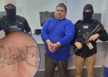 ¡Intentó borrar su pasado! Detienen en El Amatillo a pandillero salvadoreño que ocultó sus tatuajes