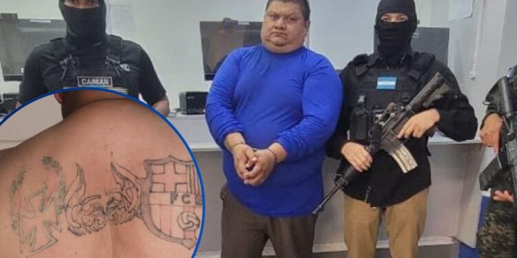 ¡Intentó borrar su pasado! Detienen en El Amatillo a pandillero salvadoreño que ocultó sus tatuajes