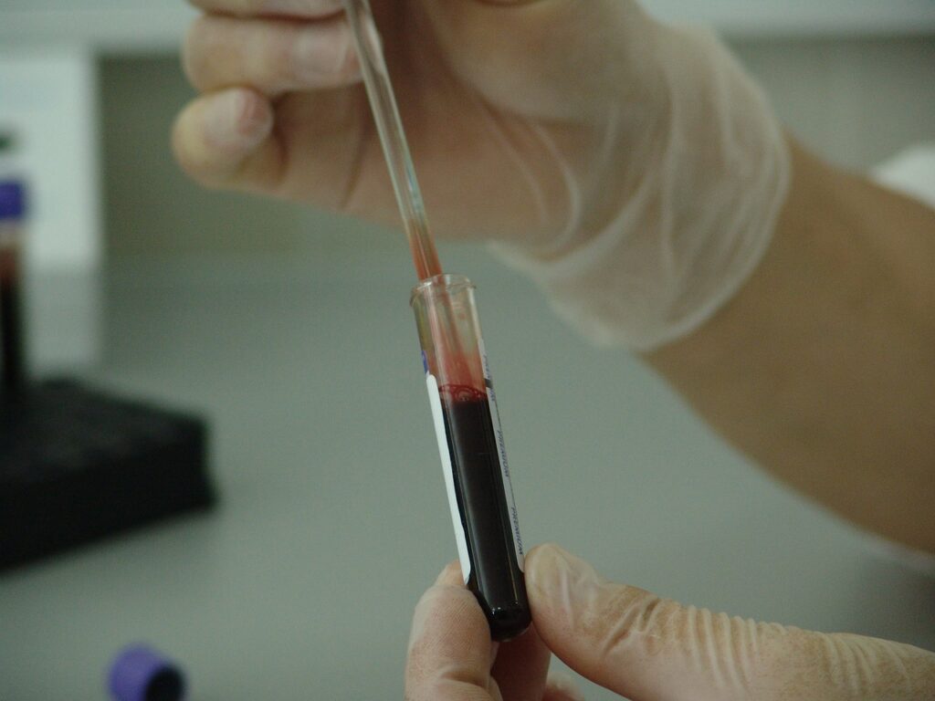 China reporta el primer caso grave en humanos del virus Oya