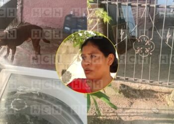 Pitbull ataca a niña de 11 años y la deja sin oreja en SPS
