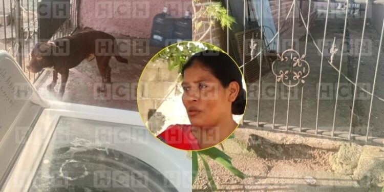 Pitbull ataca a niña de 11 años y la deja sin oreja en SPS