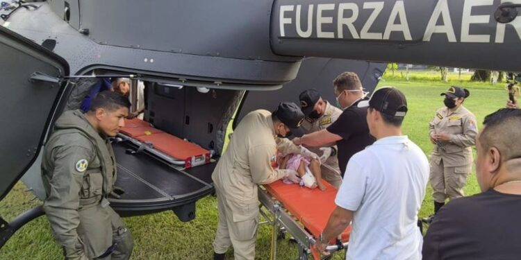 Trasladan a menor de un año con quemaduras en gran parte de su cuerpo