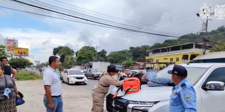 ¡Impacto en la CA-13! Accidente vial en la CA-13 deja a un joven herido en Tela