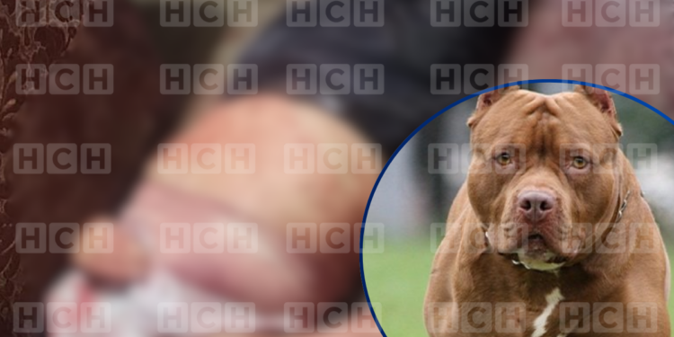 Como Ulises Alonzo identifican al hombre que murió tras ataque de su pitbull en el Hato de Enmedio