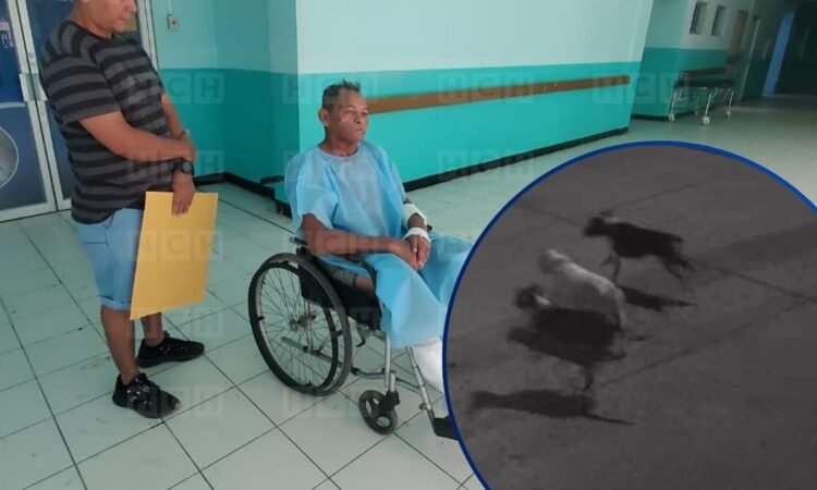 ¡Tres pitbulls casi lo matan! Ceibeño narra a HCH cómo sobrevivió al feroz ataque