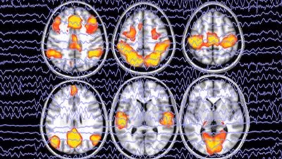 IA logra reconstruir lo que una persona está viendo con un escáner cerebral